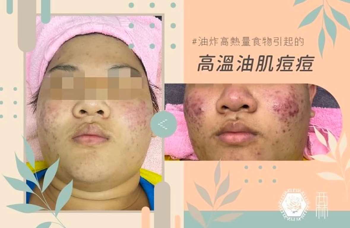 新網站上線，請多多支持!